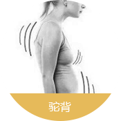 駝背